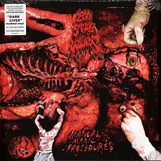 200 Stab Wounds - Manual Manic Procedures Dark Liver Marbled Vinyl Edition