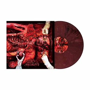 200 Stab Wounds - Manual Manic Procedures Dark Liver Marbled Vinyl Edition