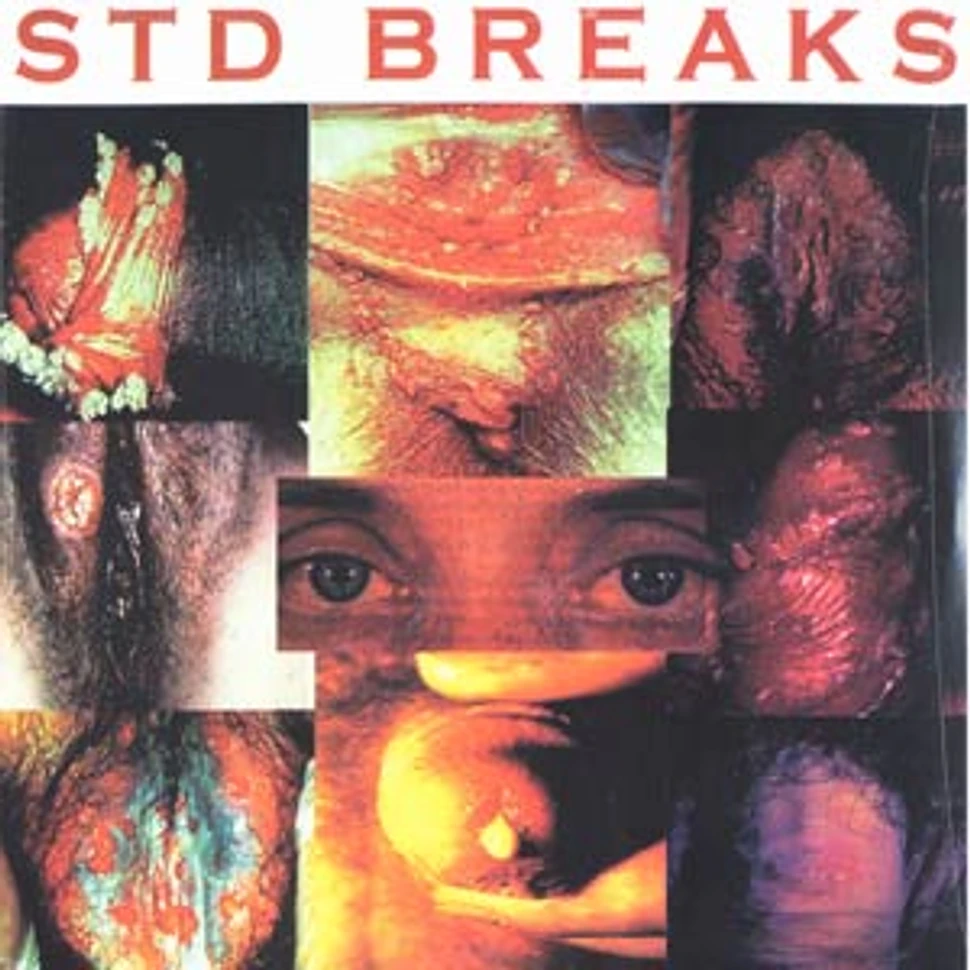 D-Styles - Sexually Transmitted Disease Breaks