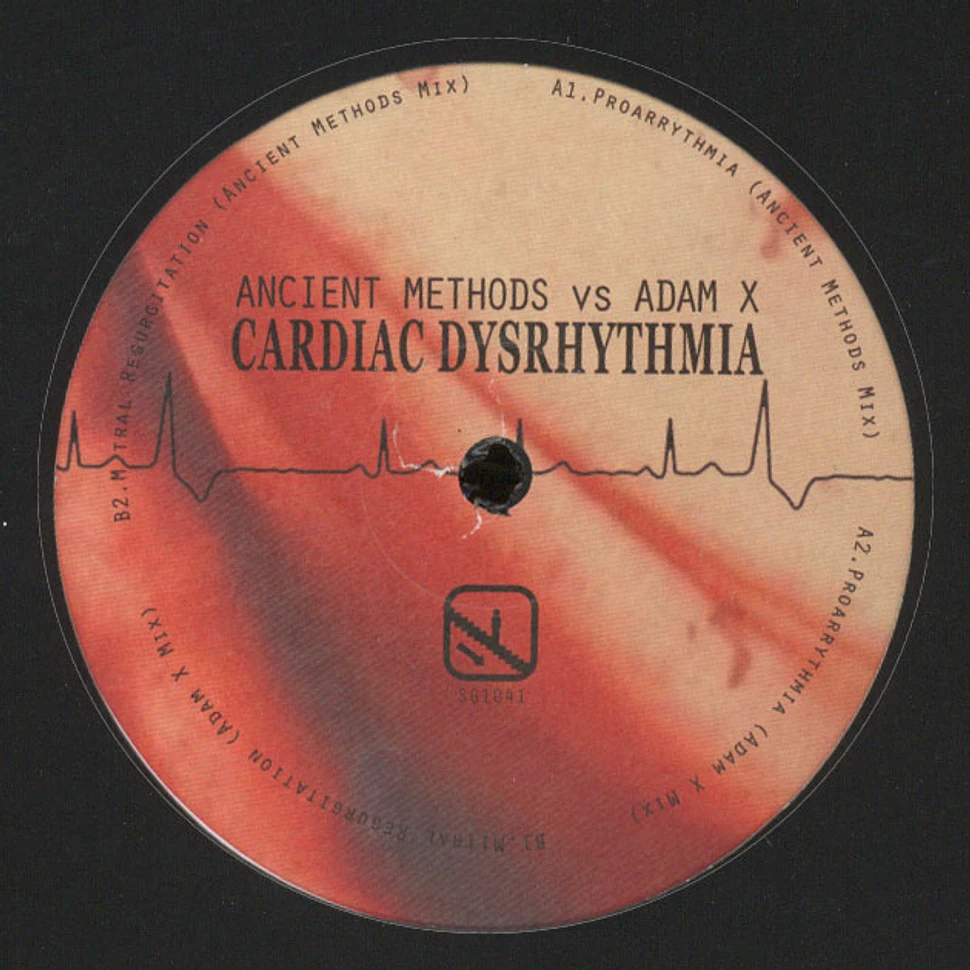 Ancient Methods Vs. Adam X - Cardiac Dysrhythmia