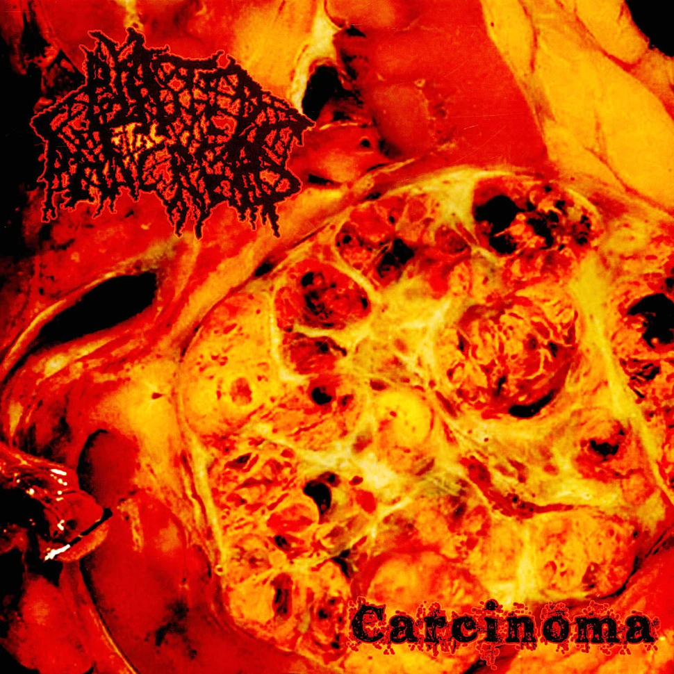 Blasted Pancreas - Carcinoma Red Vinyl Edition
